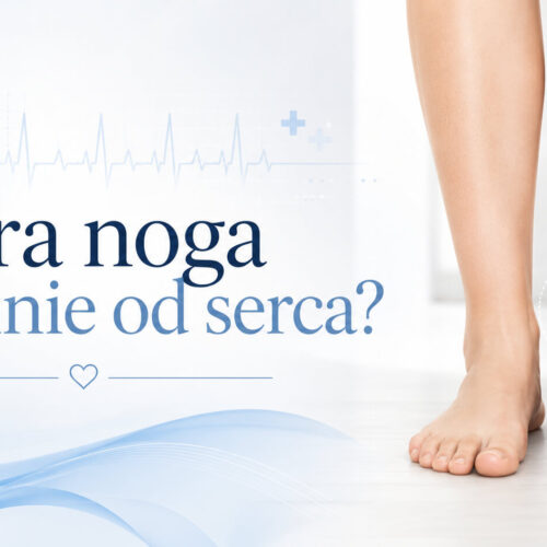 Która noga puchnie od serca? Odkryj przyczyny i rozwiązania